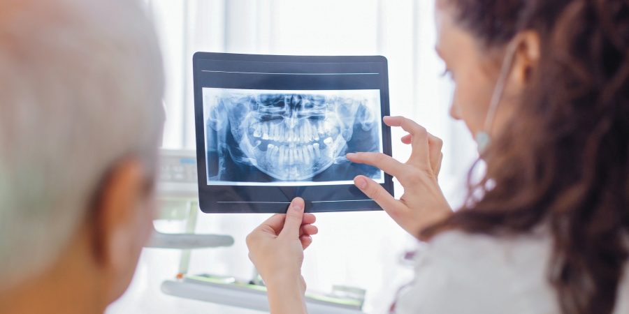Zahnimplantate: Rrisiken und Nebenwirkungen lässt sich ein Patient erklären.