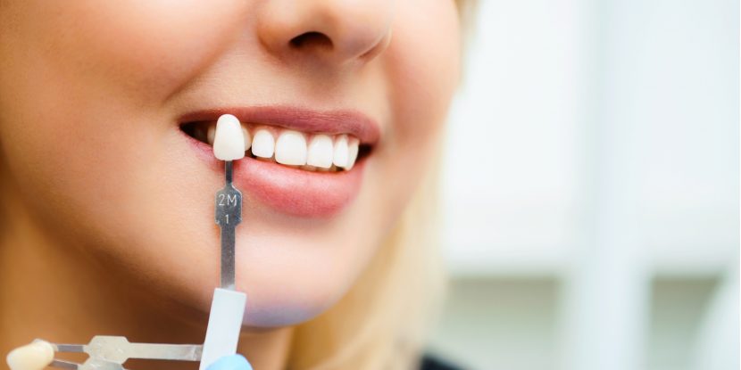 Zahnimplantat: Zahnfarbnabhme für Implantat-Zahn