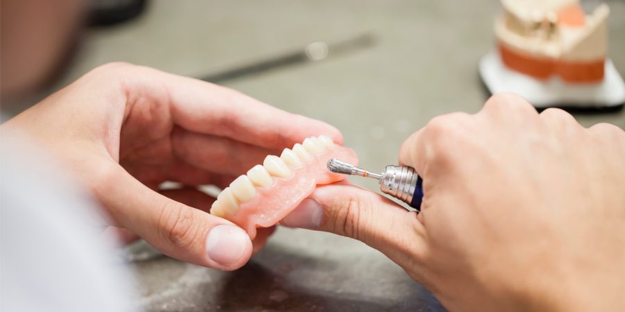 Anfertigung von Zahnersatz auf Implantaten