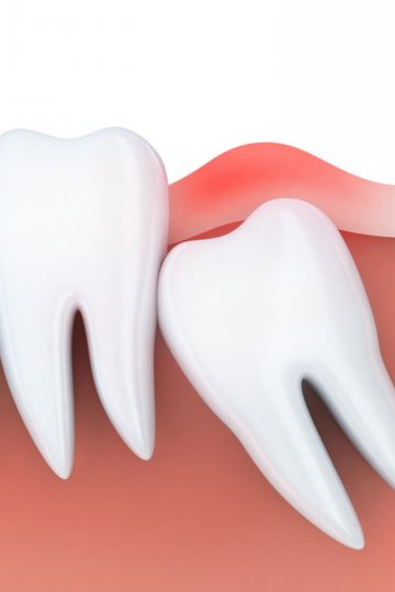 Weisheitszahn-Klinik am Schloss