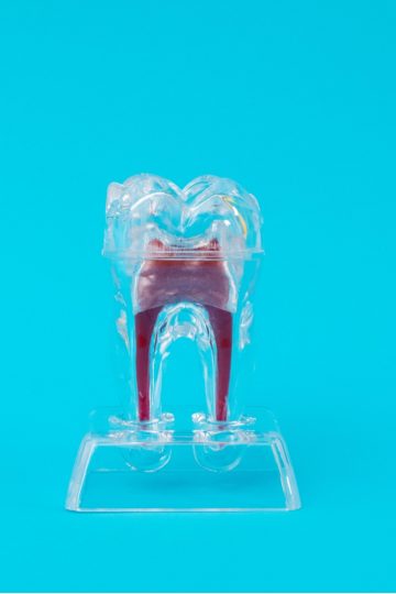 Wurzelbehandlung-Klinik am Schloss