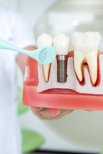 Zahnimplantat-Klinik am Schloss